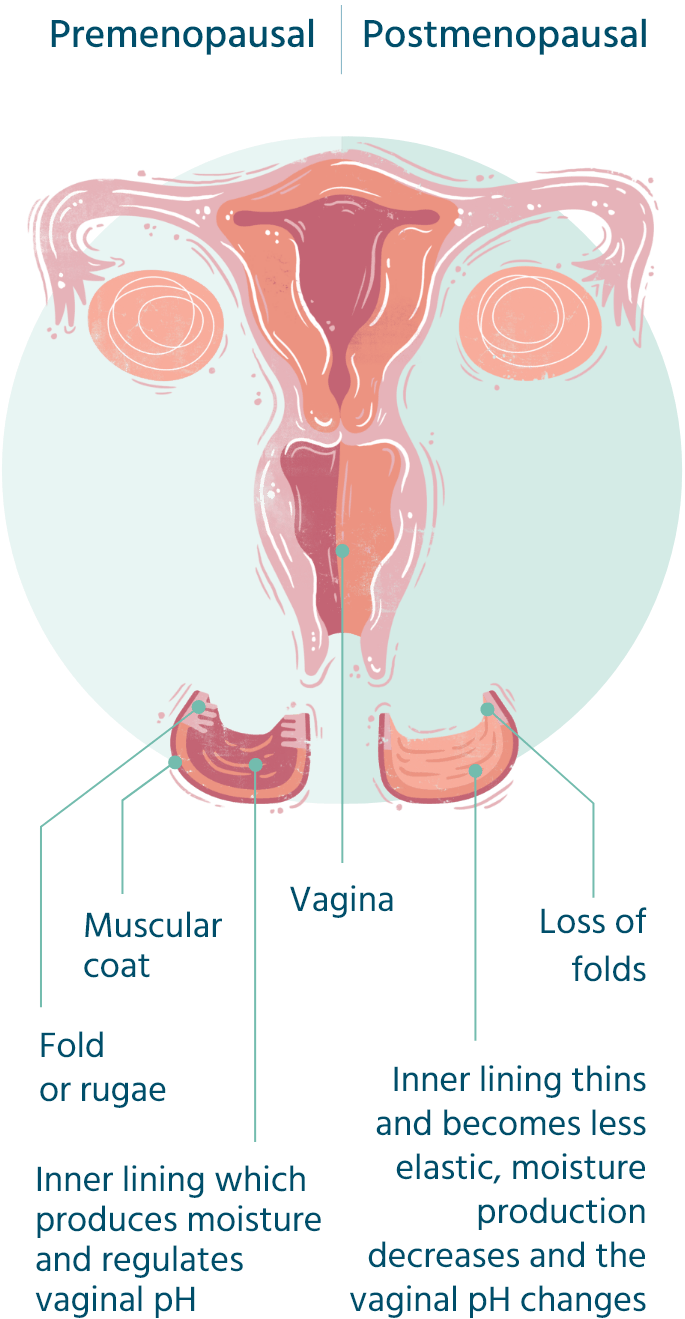 Postmenopausal changes diagram